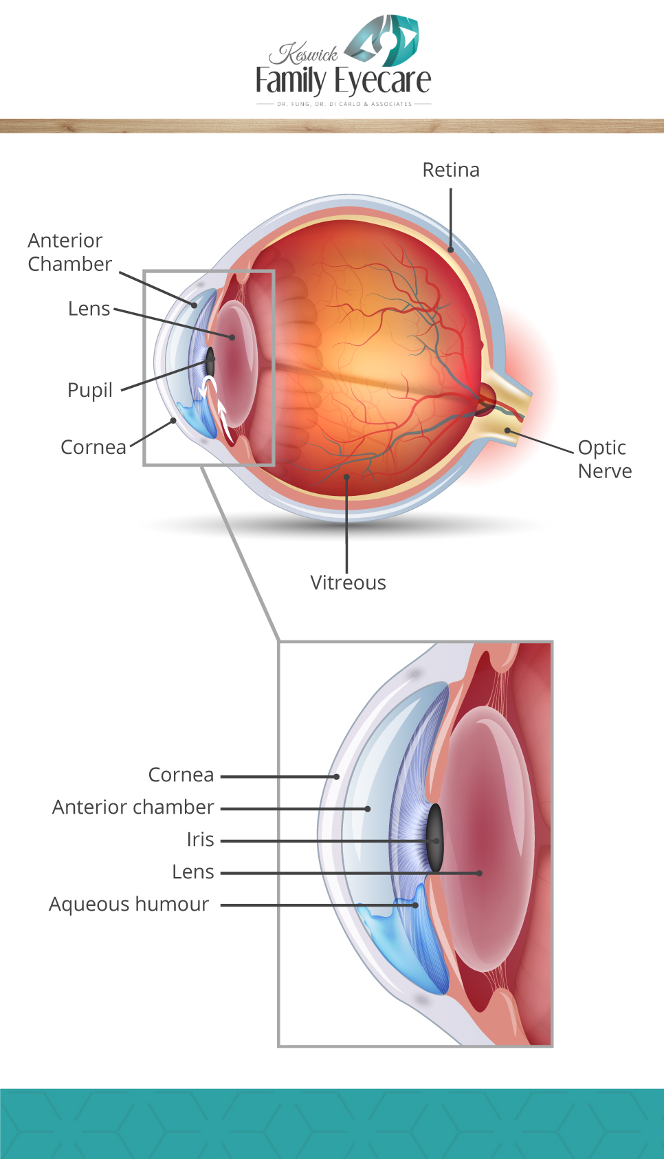 glaucoma eye diagram